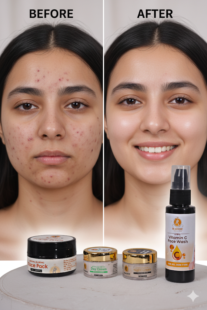 રાધે બ્યુટી કેર નેચરલ એજ કન્ટ્રોલ ડે ક્રીમ (પ્રદૂષણ રક્ષણ) - Image 6